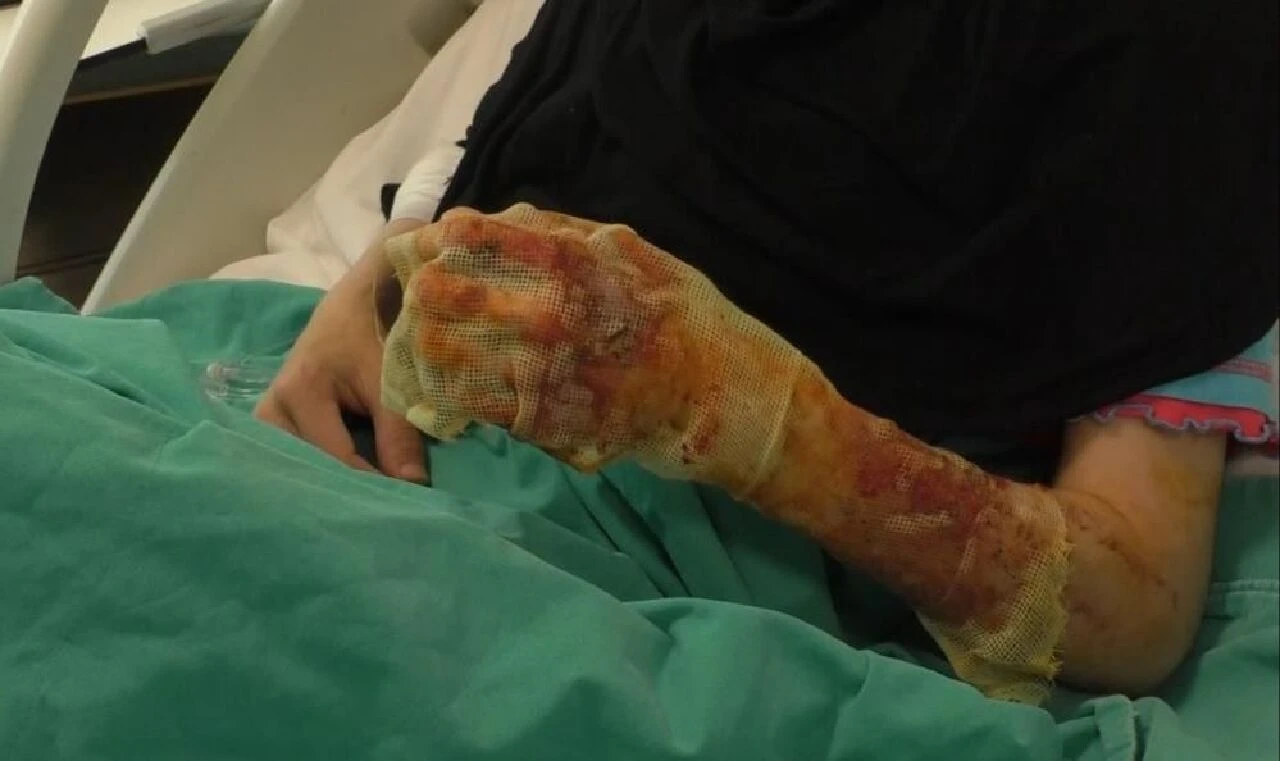 Mangalcılar dikkat! Sakın bunu yapmayın: Harlamak istedi ölümden döndüler - 2. Resim