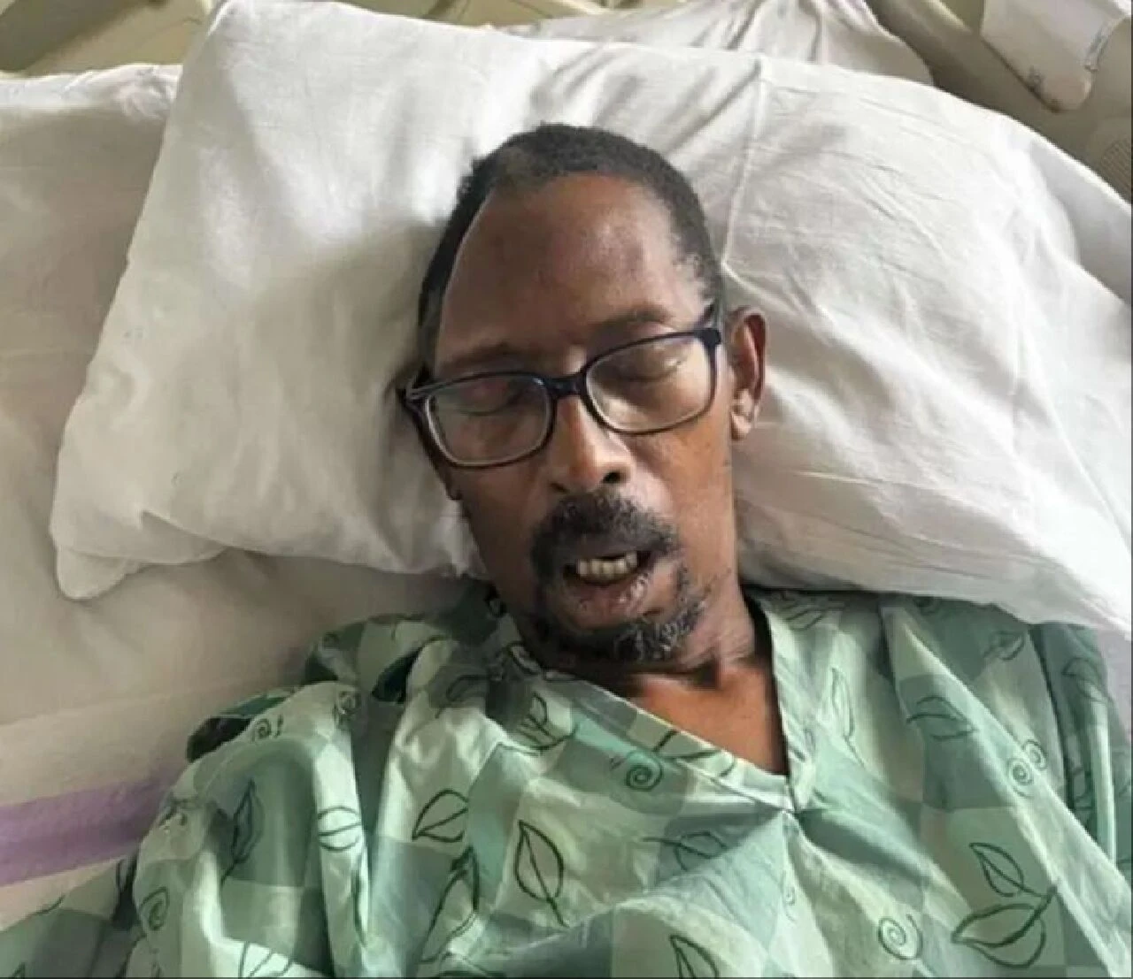 Vücudunun bir parçasını kaybeden hastane skandallara imza attı! ABD'de bir garip olay - 1. Resim