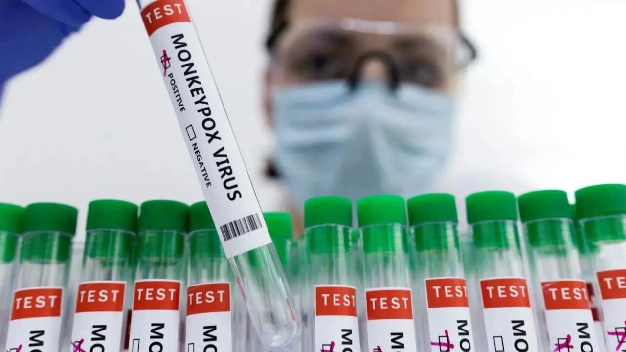 En az 570 M çiçeği virüsü ölümü ve binlerce vaka var! Kongo'da maymun çiçeği yayılıyor