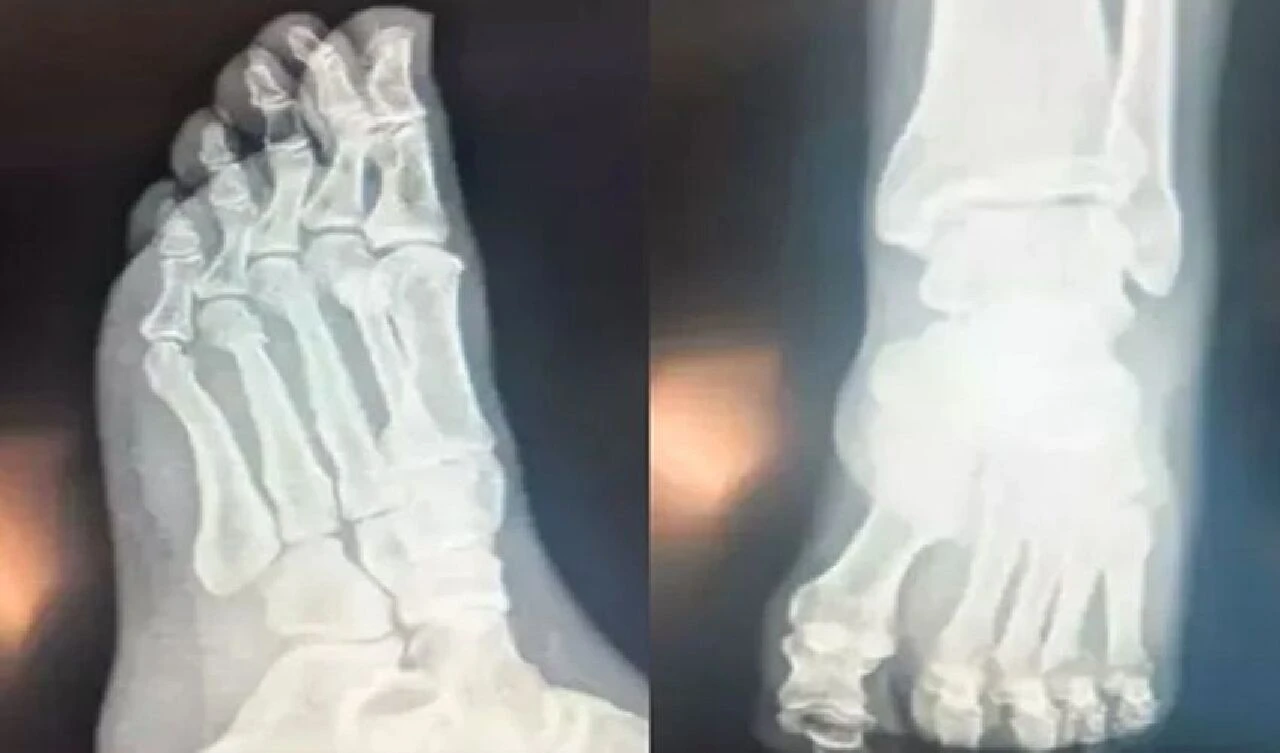 Özgür Özel'den iddialara röntgen filmli cevap! 'FETÖ'cü hesapların yaydığı bir yalan