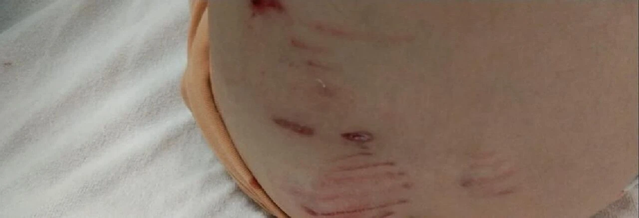 Yine başıboş sokak köpeği dehşeti! Minik kız oyun oynarken kâbusu yaşadı - 2. Resim