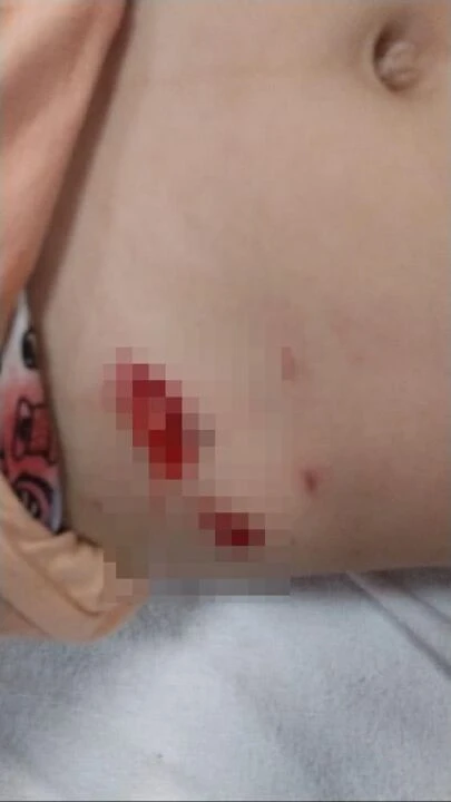 Yine başıboş sokak köpeği dehşeti! Minik kız oyun oynarken kâbusu yaşadı