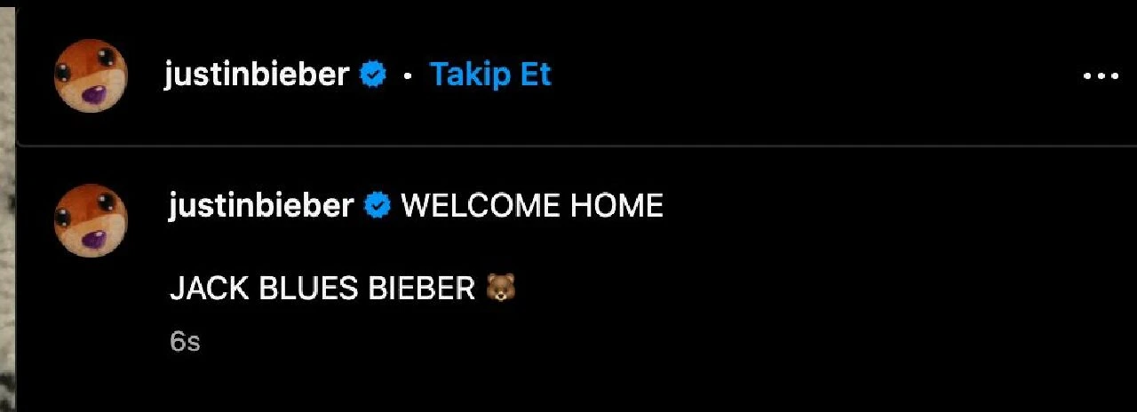 Justin - Hailey Bieber çiftinin bebeğinin ismi Jack Blues oldu