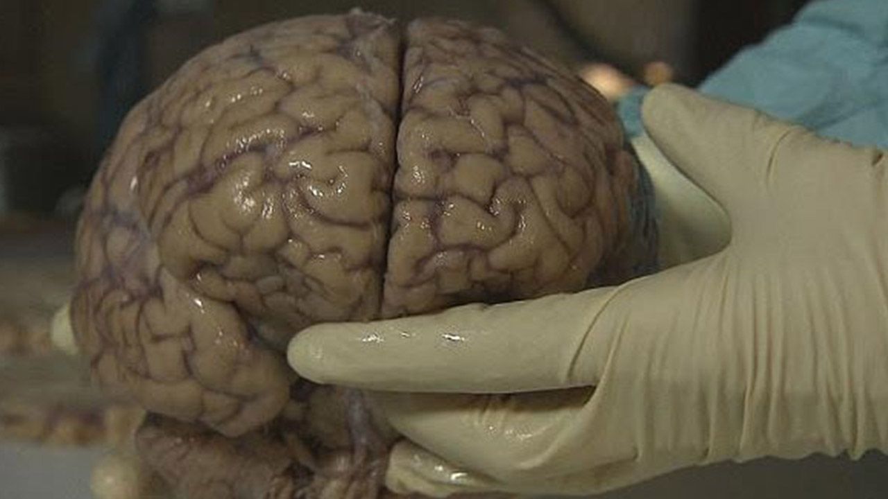 Beyin sağlığı için en güçlü 10 süper besin!  Alzheimer riskini azaltıyor