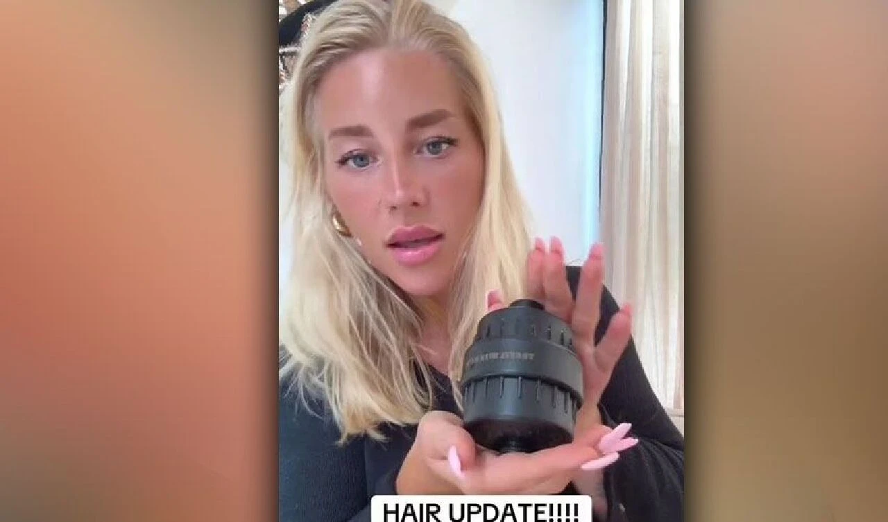 Tatil dönüşü kel kaldı! Nedenini öğrenince iş kurup başına gelenleri fırsata çevirdi - 3. Resim