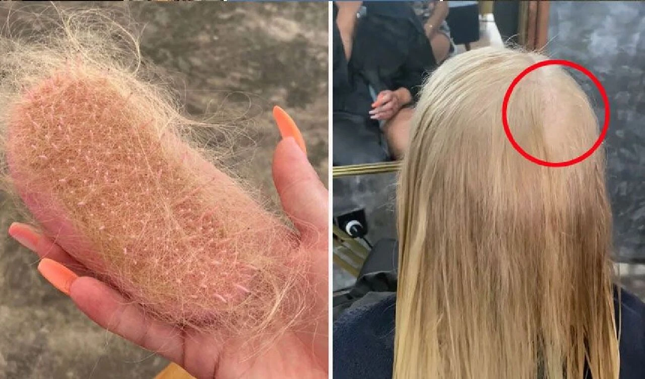 Tatil dönüşü kel kaldı! Nedenini öğrenince iş kurup başına gelenleri fırsata çevirdi - 2. Resim