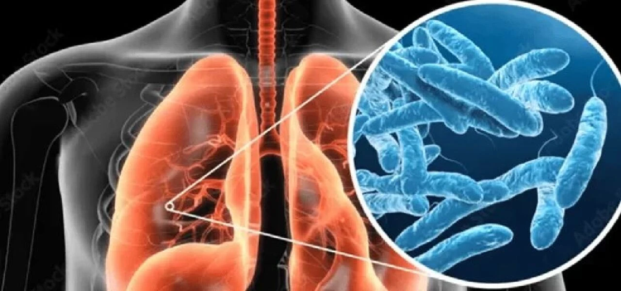 Lejyonella bakterisi öldürmeye devam ediyor! Evlere ulaşan su kaynakları araştırılıyor - 1. Resim