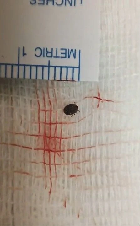 Bitlis'te şoke eden olay! Sokakta kedi sevdi gözünden çıkan şey doktorları bile hayrete düşürdü - 2. Resim