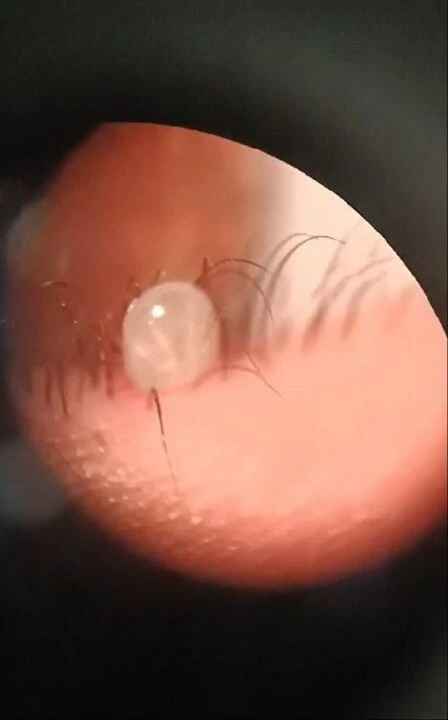 Bitlis'te şoke eden olay! Sokakta kedi sevdi gözünden çıkan şey doktorları bile hayrete düşürdü - 1. Resim