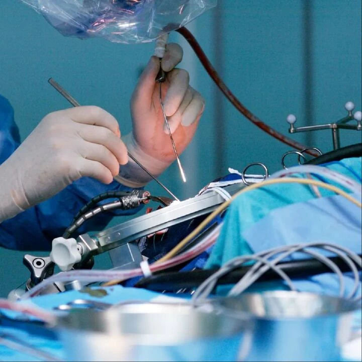 Doktorun çocuğu ameliyata girdi, hastanın kafatasına delik açtı! Ülke bu skandalı konuşuyor - 2. Resim