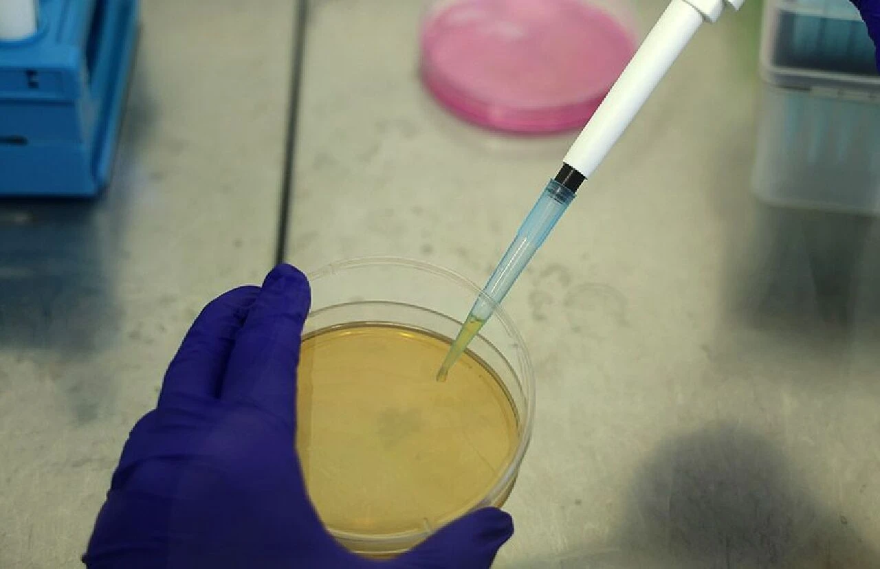 Maymun çiçeği vürüsüne çare Türkiye'de! Sivas'ın propolisi maymun çiçeğine şifa olacak - 1. Resim