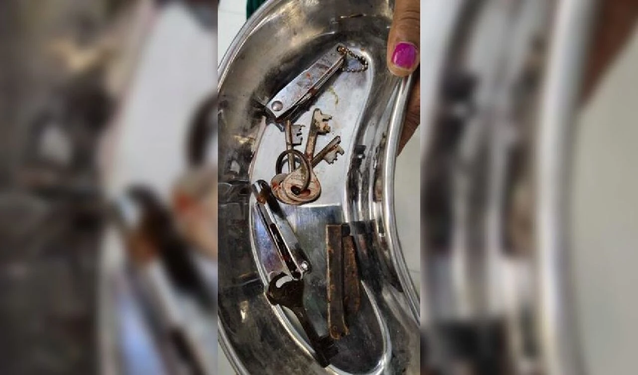 Midesinde yok yok! Karın ağrısıyla gittiği hastanede doktorları şoke etti