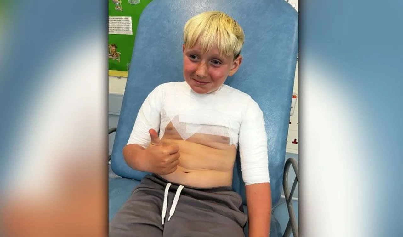 Sadece 2 saat içinde vücudu kabarcıklarla doldu! Anne çocuğunun başına gelenleri anlatıp, uyardı - 3. Resim