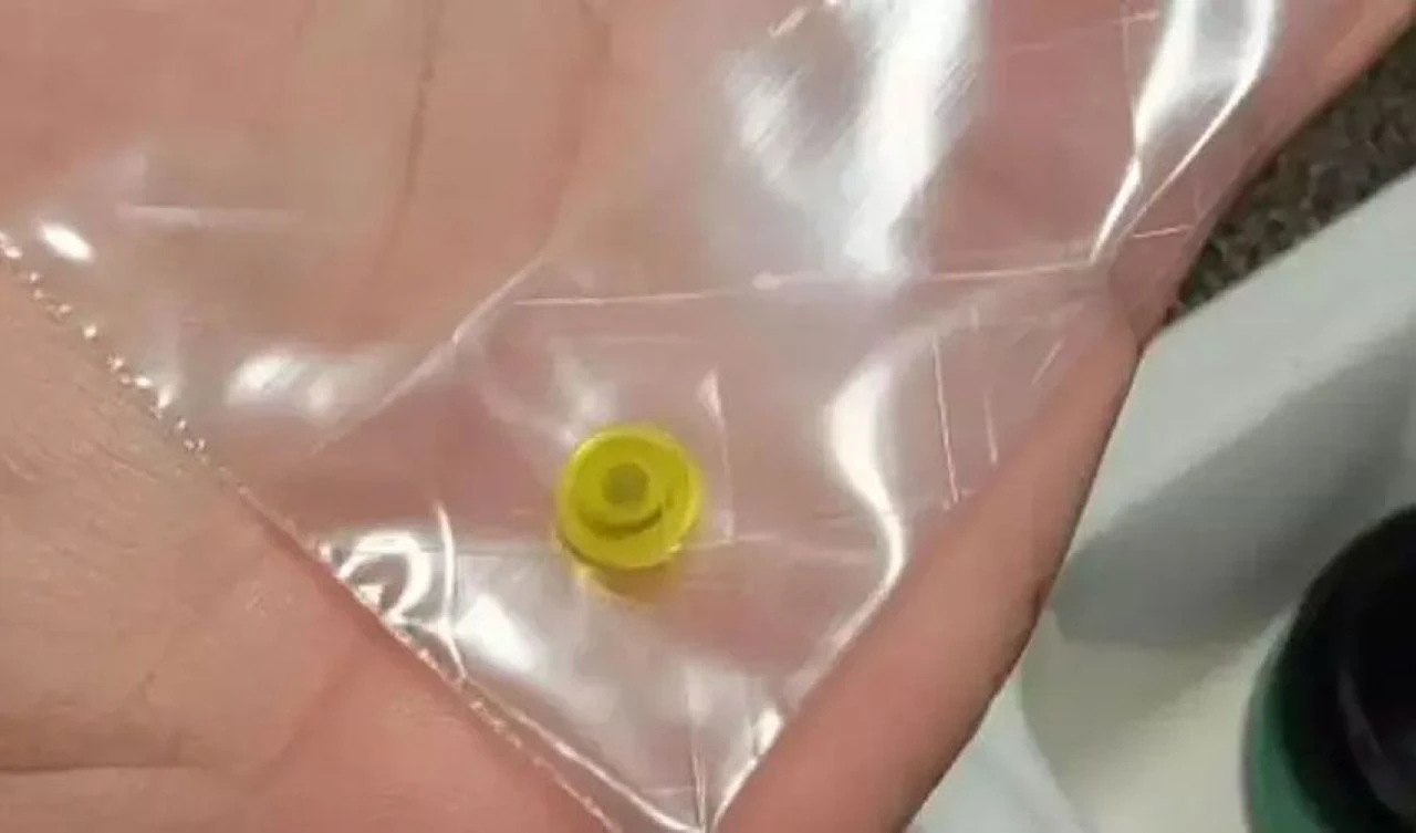 Senelerce nefes almakta zorlandı! Bir hapşırığıyla 26 sene burnunda taşıdığı nesneyi görünce şoke oldu - 2. Resim