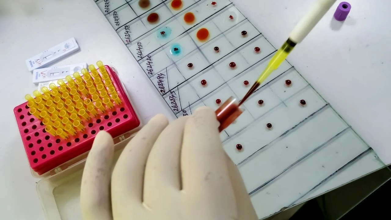 MAL kan grubu, AnWj antijenini içeren ve nadir bulunan gruptur