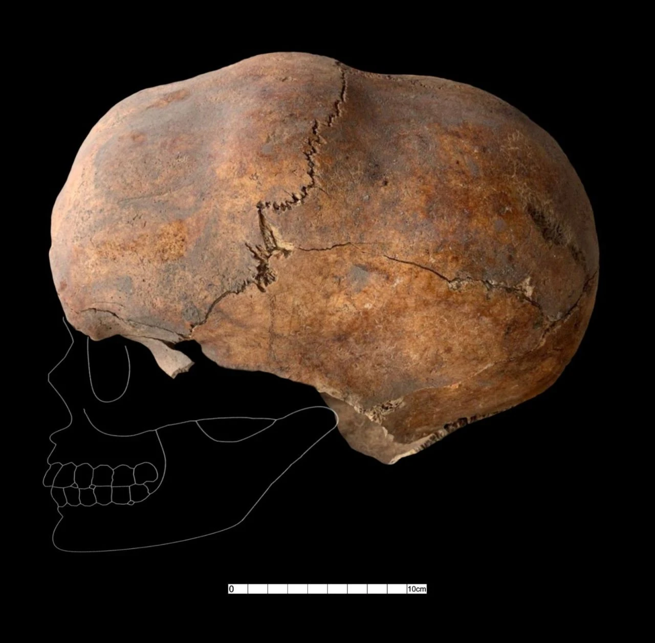 Kahramanmaraş'ta meraklandıran keşif! 6 bin yıllık kafatası bulundu - 2. Resim