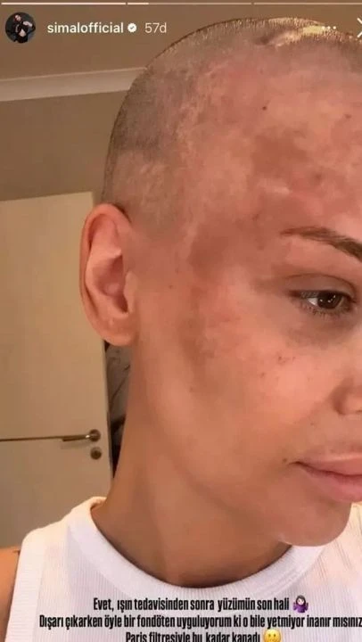Şarkıcı Şimal son halini paylaştı, takipçilerini uyardı: Bunu 2 kez yaşamış biri olarak söylüyorum - 2. Resim