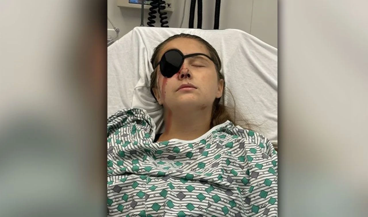 Genç kızın gözü 'duvara fırlatılmış üzüm gibi' patladı! Başına gelenleri bir bir anlattı - 1. Resim