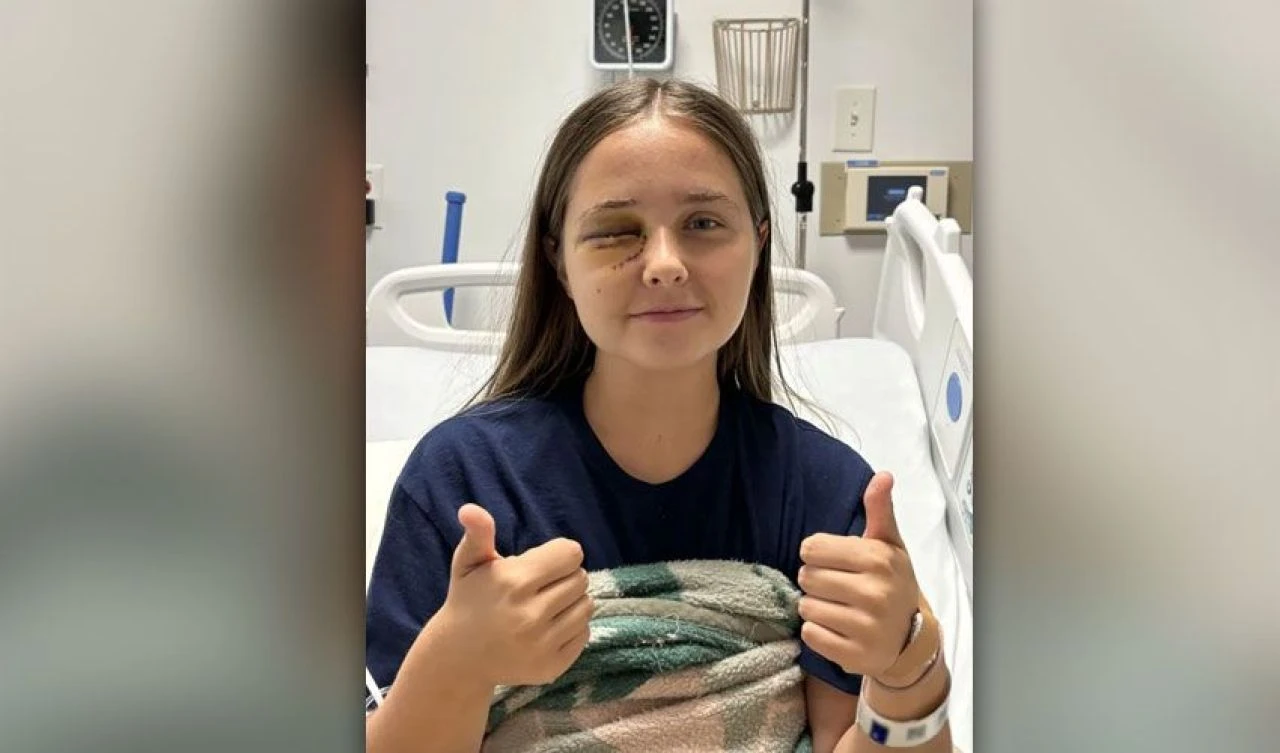 Genç kızın gözü 'duvara fırlatılmış üzüm gibi' patladı! Başına gelenleri bir bir anlattı - 4. Resim