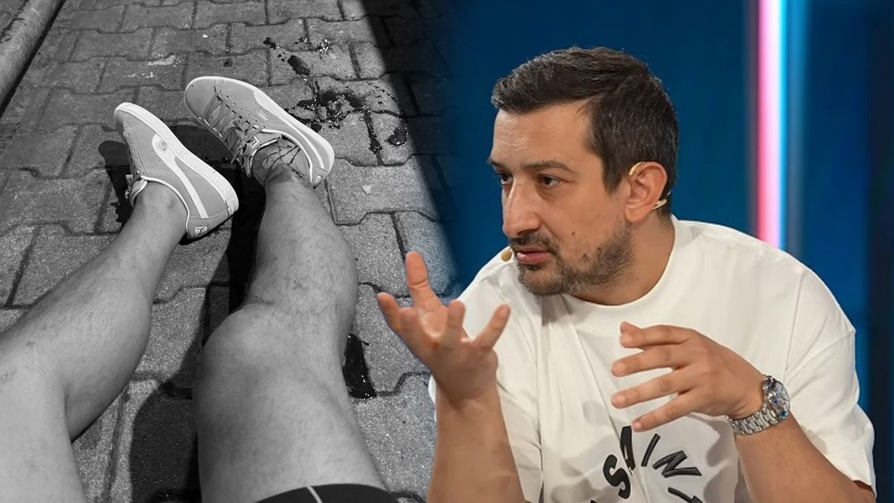 Serhat Akın saldırı sonrası ilk kez konuştu! 'Kumar borcu' iddialarına sert sözlerle yüklendi - 2. Resim