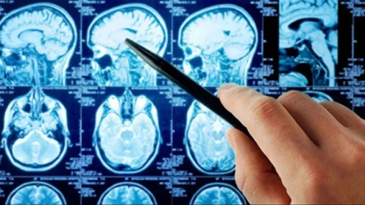 Koronavirüs aşısında çığır açan Aziz Sancar'dan 'beyin kanseri' çalışması! 2 yıl boyunca insanlarda denenecek - 3. Resim