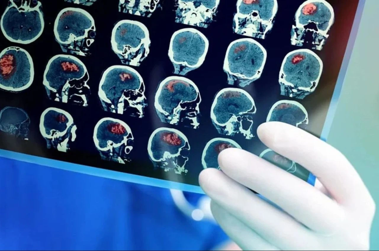 Koronavirüs aşısında çığır açan Aziz Sancar'dan 'beyin kanseri' çalışması! 2 yıl boyunca insanlarda denenecek - 1. Resim