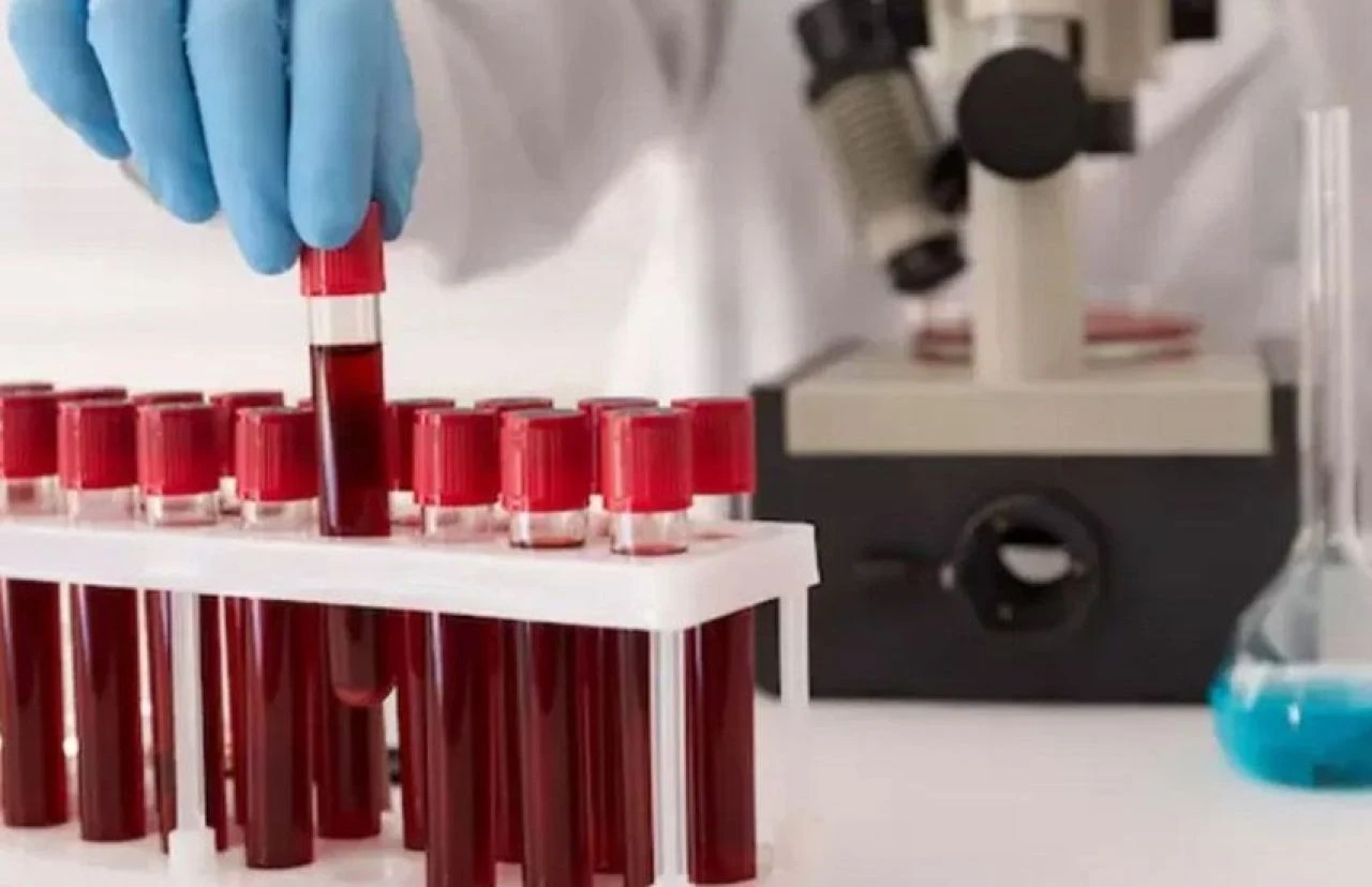 Bu kan grubu sahipleri dikkat! Covid-19'un yeni tehlikesi keşfedildi - 2. Resim