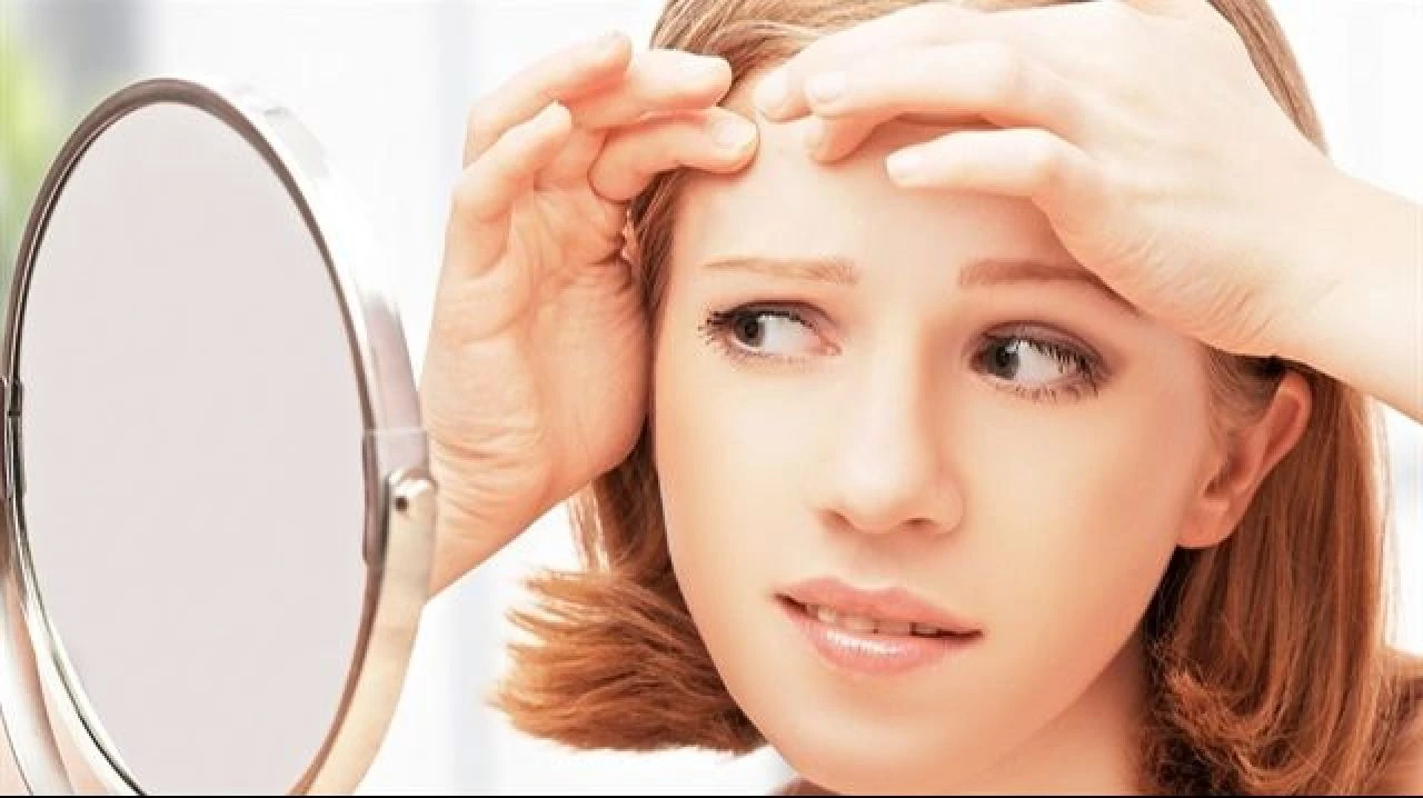 Sivilce izlerine iyi gelen şeyler: Pürüzsüz cilt için sivilce lekelerine iyi gelen yağlar, bitkiler ve sabunlar neler? - 4. Resim