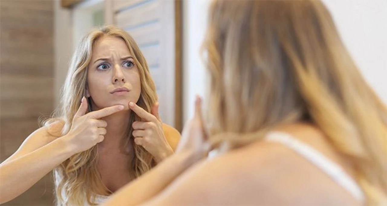 Sivilce izlerine iyi gelen şeyler: Pürüzsüz cilt için sivilce lekelerine iyi gelen yağlar, bitkiler ve sabunlar neler? - 2. Resim