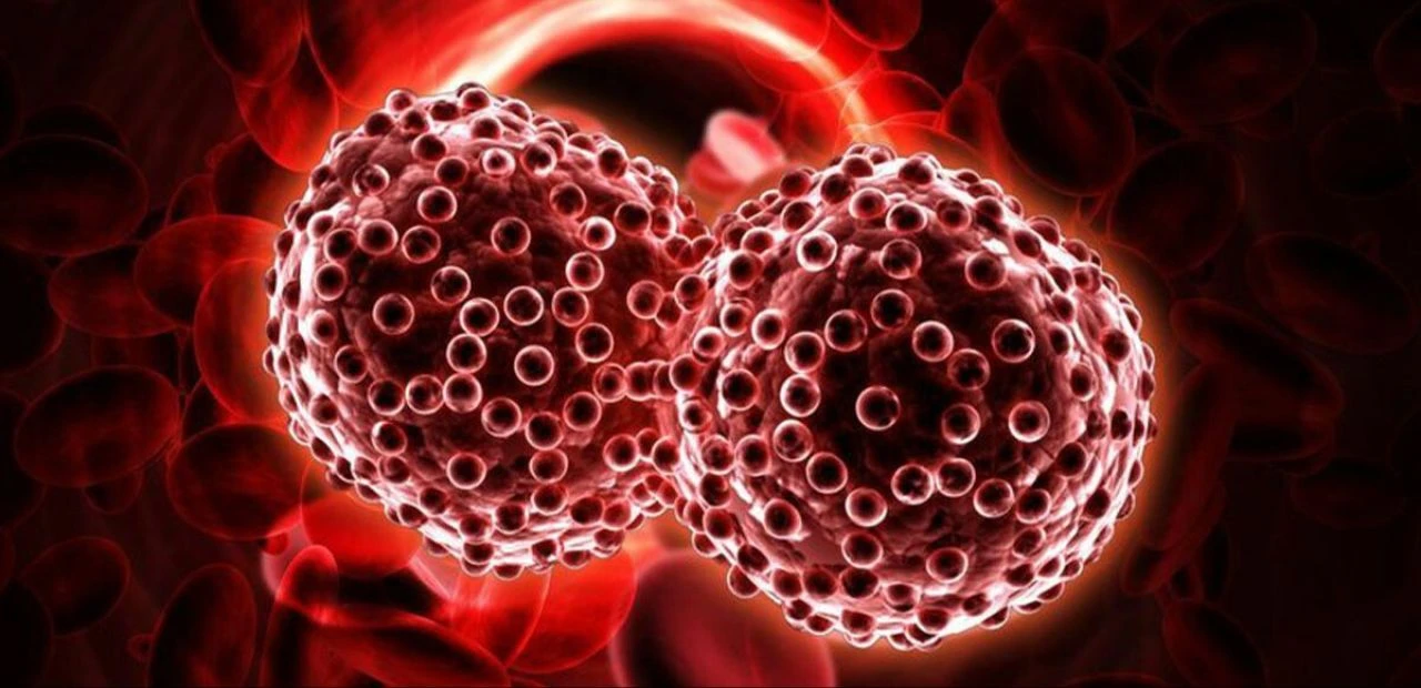 Pankreas kanserinin en çok görüldüğü kişiler belli oldu - 1. Resim