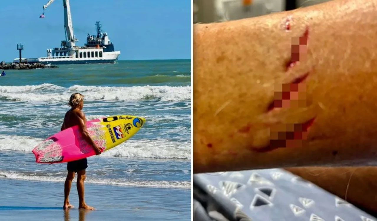 Tahtadan köpek balığının üzerine indi! Kanlar içinde kıyıya vardı - 2. Resim