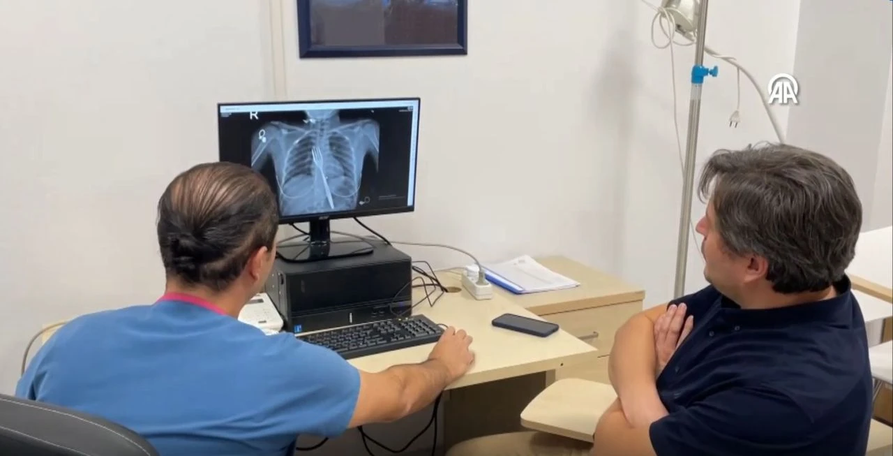 Doktorlar da şoke oldu! 18 santimlik çatalı tek hamlede yuttu: Bilimsel makale olacak - 3. Resim