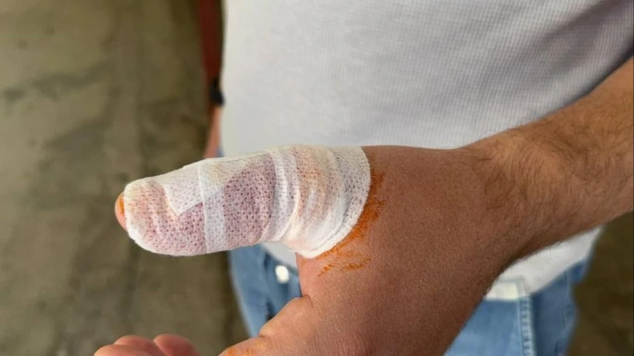 Aslan balığını ölü sandı, dokunca hastanelik oldu! "Çok değişik bir acıydı"