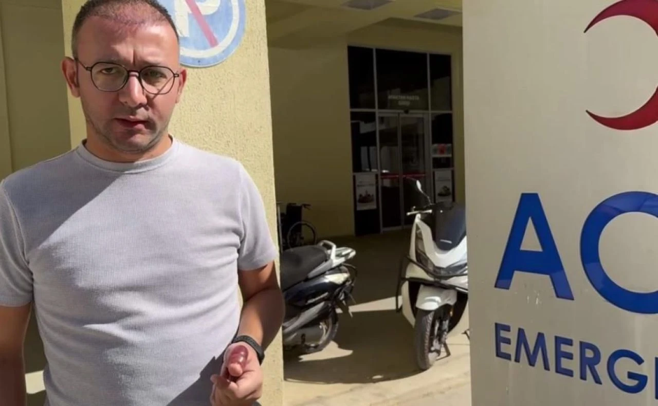 Aslan balığını ölü sandı, dokunca hastanelik oldu! "Çok değişik bir acıydı"