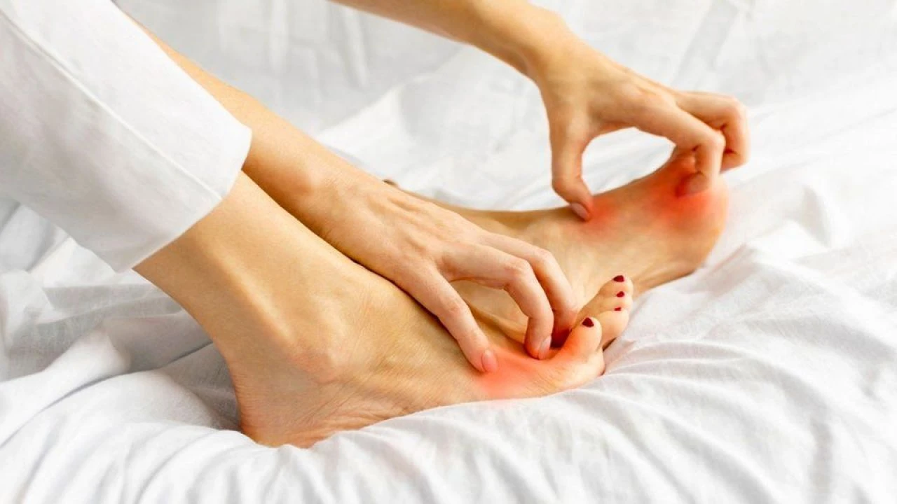 Ayak mantarı neden olur, nasıl geçer? Ayak mantarına ne iyi gelir? - 3. Resim