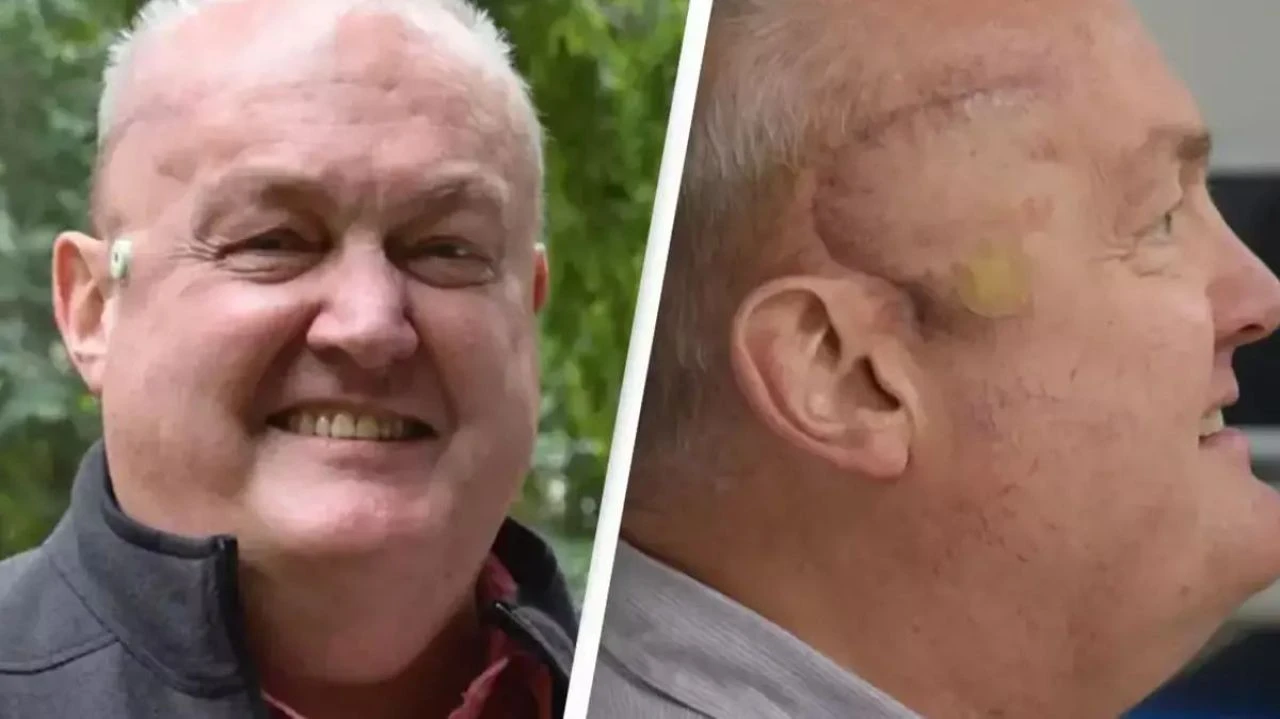 Beyin tümörü hastaları için yeni tedavi umut ışığı oldu: Yarı yarıya küçüldü - 1. Resim