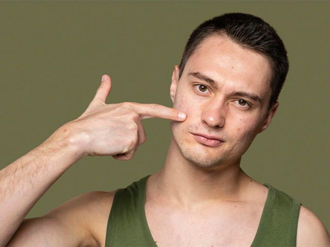 Sivilce lekeleri neden olur, nasıl geçer? Sivilce lekelerine ne iyi gelir? - 2. Resim