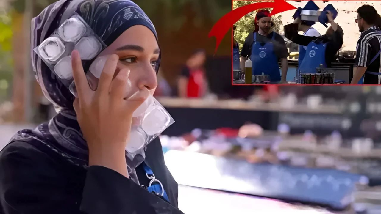 Yüzüne kızgın yağ dökülmüştü: MasterChef Türkiye'de Beyza sürprizi - 1. Resim