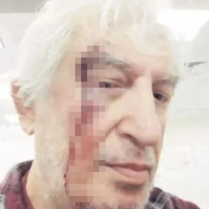 Emekli profesöre sazan sarmalı! Dolandırdıkları yetmedi bir de darp ettiler: Tam 22 milyon lira kaptırdı - 3. Resim