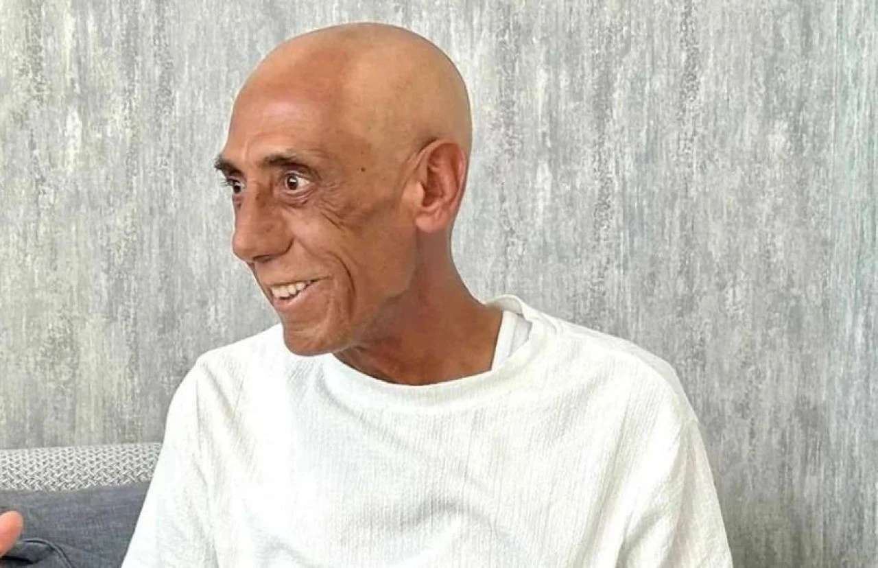 Ankaralı Turgut'un son sağlık durumuyla ilgili yeni açıklama!