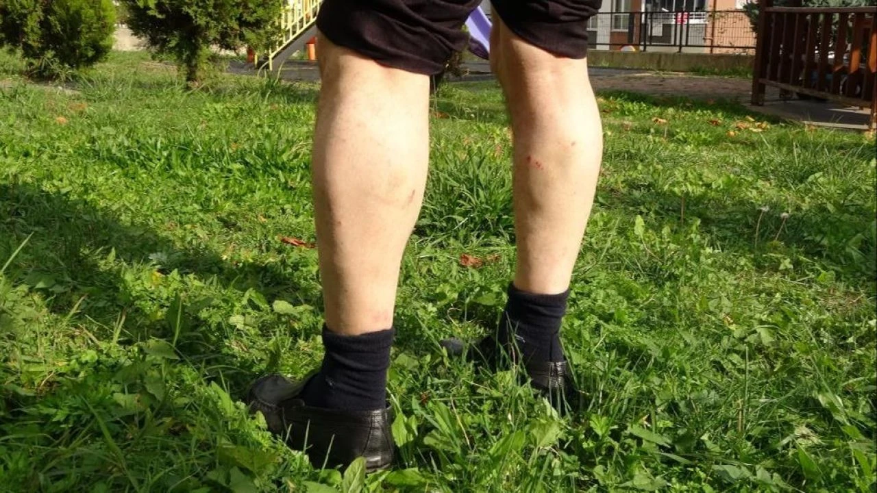 Ordu'da başıboş sokak köpeği dehşeti! İsyan edip, yetkililere çağrıda bulundu - 2. Resim