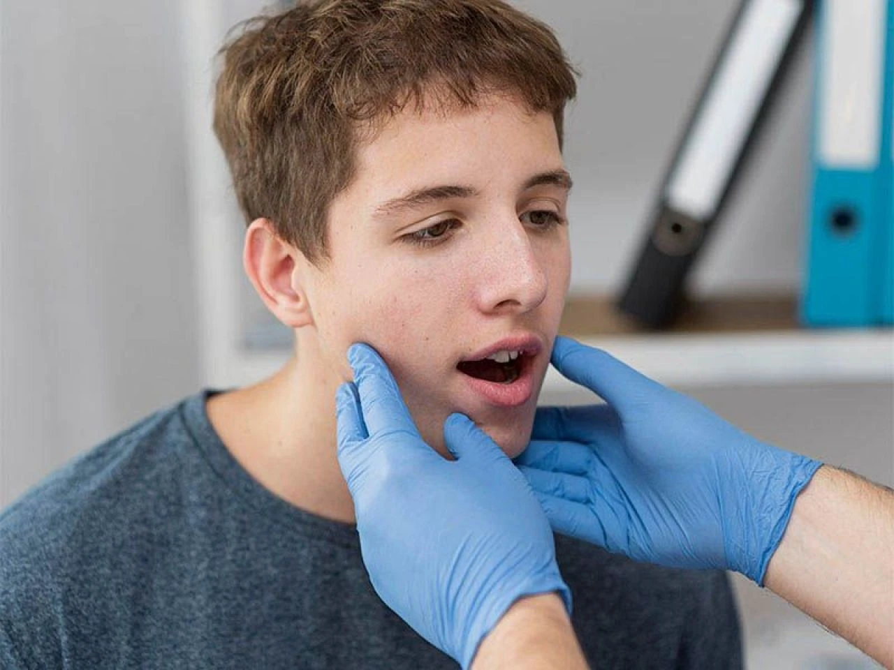 Aft nedir, neden olur ve nasıl geçer? Aft tedavisi için ne iyi gelir? - 2. Resim