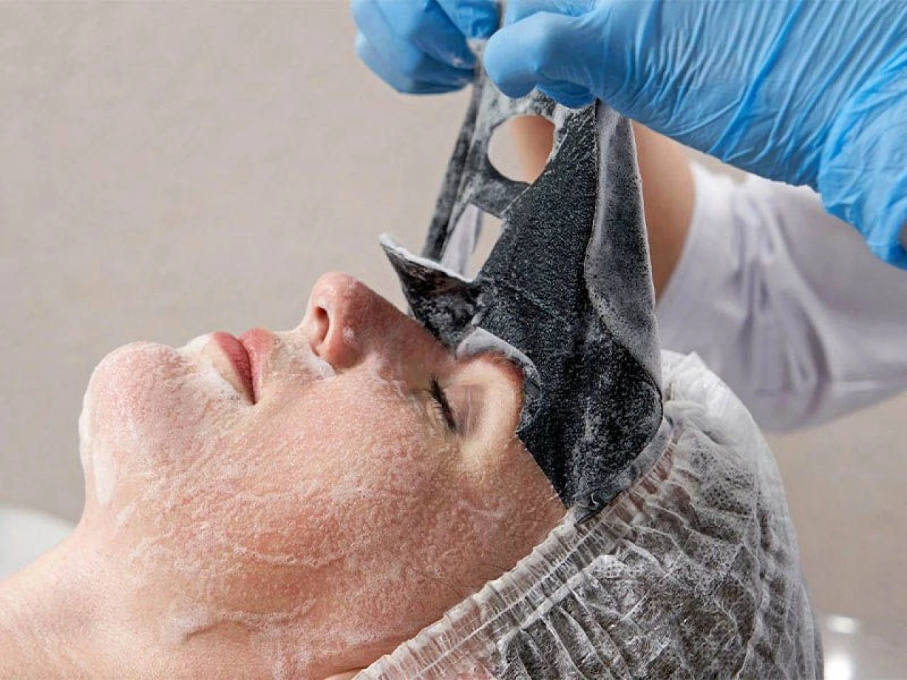 Siyah noktalara evde kesin çözüm yöntemleri: En hızlı siyah nokta nasıl geçer?