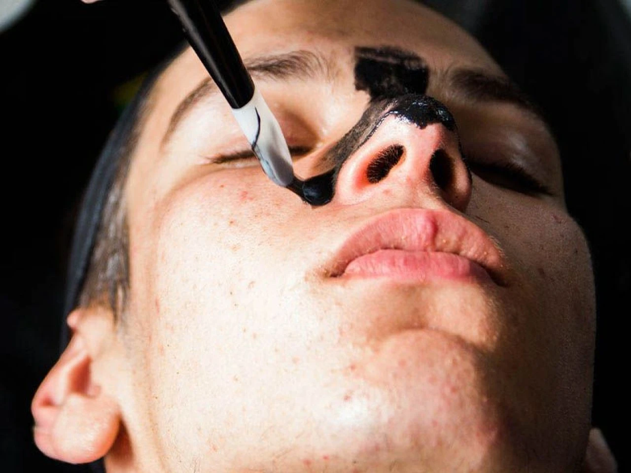 Siyah noktalara evde kesin çözüm yöntemleri: En hızlı siyah nokta nasıl geçer?