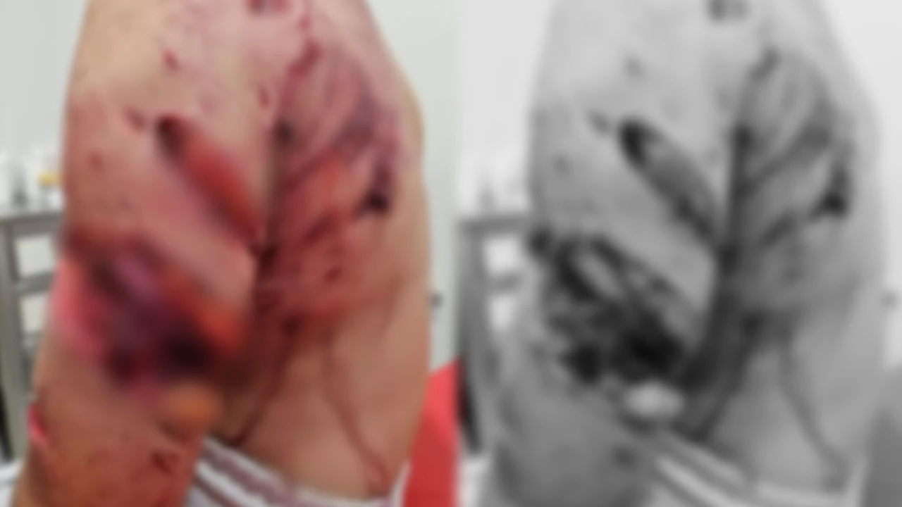 Ankara'da köpek saldırısına uğrayan çocuğun son hali dehşete düşürdü!