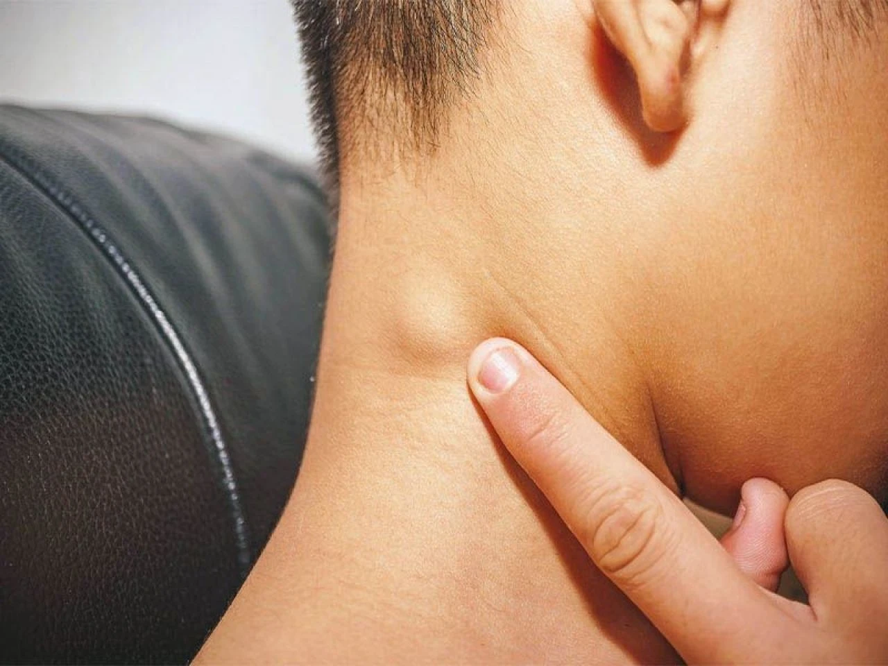 Yağ bezesine iyi gelen şeyler ve doğal çözümler: Yağ bezesine iyi gelen yağlar, bitkiler ve yiyecekler neler?