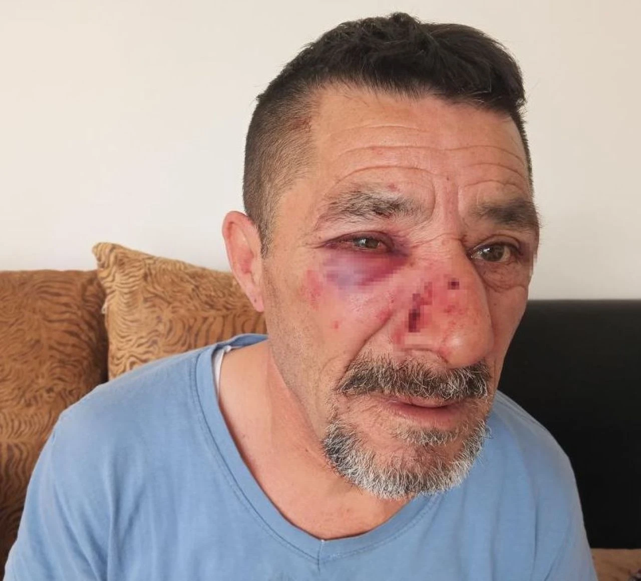 Ankara'da ev sahibi terörü! İstediği zammı kabul etmeyen engelli kiracısı ve kızını öldüresiye darbetti