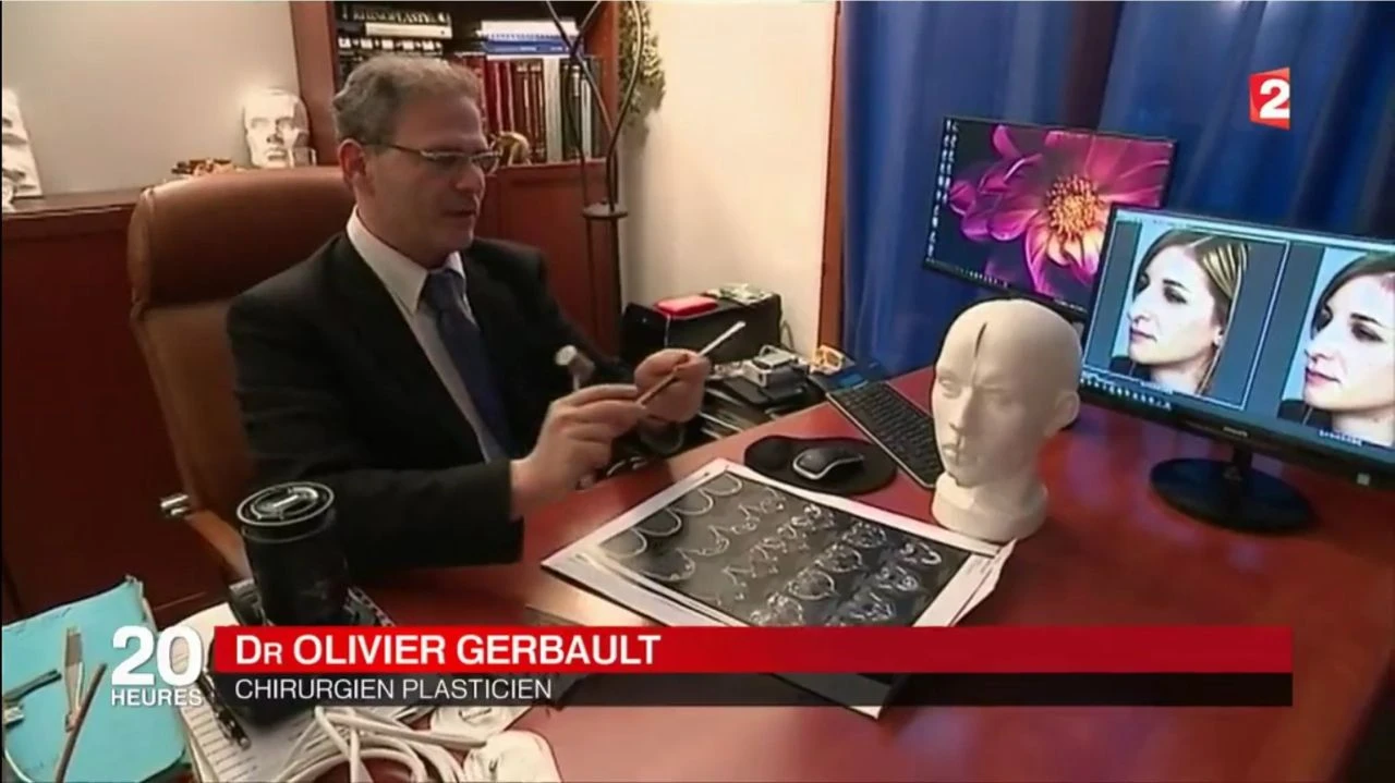 'Burun ustası' olarak tanınıyordu! Ünlü estetik cerrahı için şoke eden suçlamalar: Beni katletti - 2. Resim