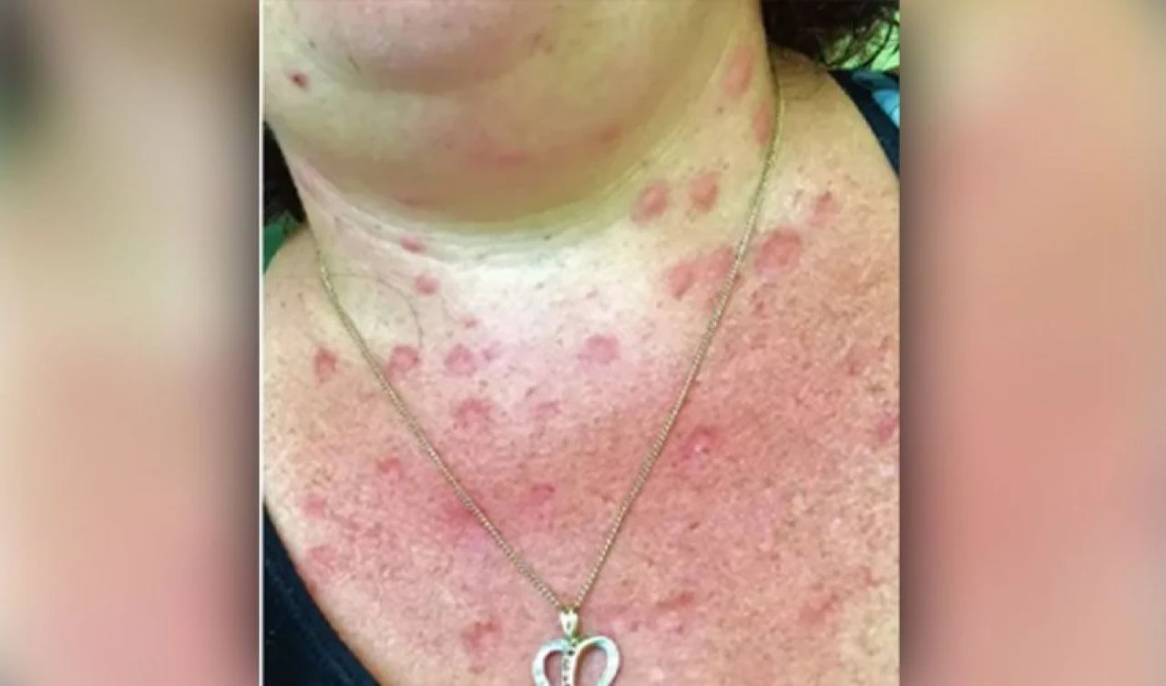 Ülkeyi ateş karıncaları topları sardı: Yıkıcı etkilere sahip istilacı tehdit - 3. Resim