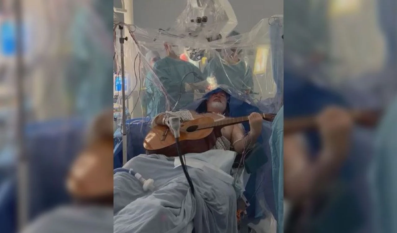 Beyin ameliyatı sırasında durmaksızın yaptığı herkesi şaşırttı - 1. Resim